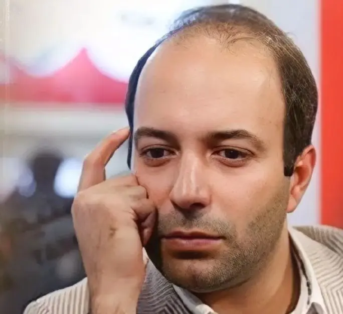 تصویر روز | تغییر چهره دیدنی کامران نجفزاده از گذشته تا به امروز 1658824558e7e6