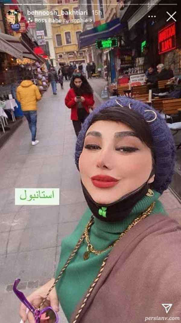 چهره متفاوت بهنوش بختیاری بازیگر چهره متفاوت بهنوش بختیاری