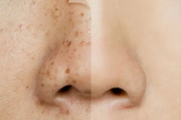 نیاسینامید