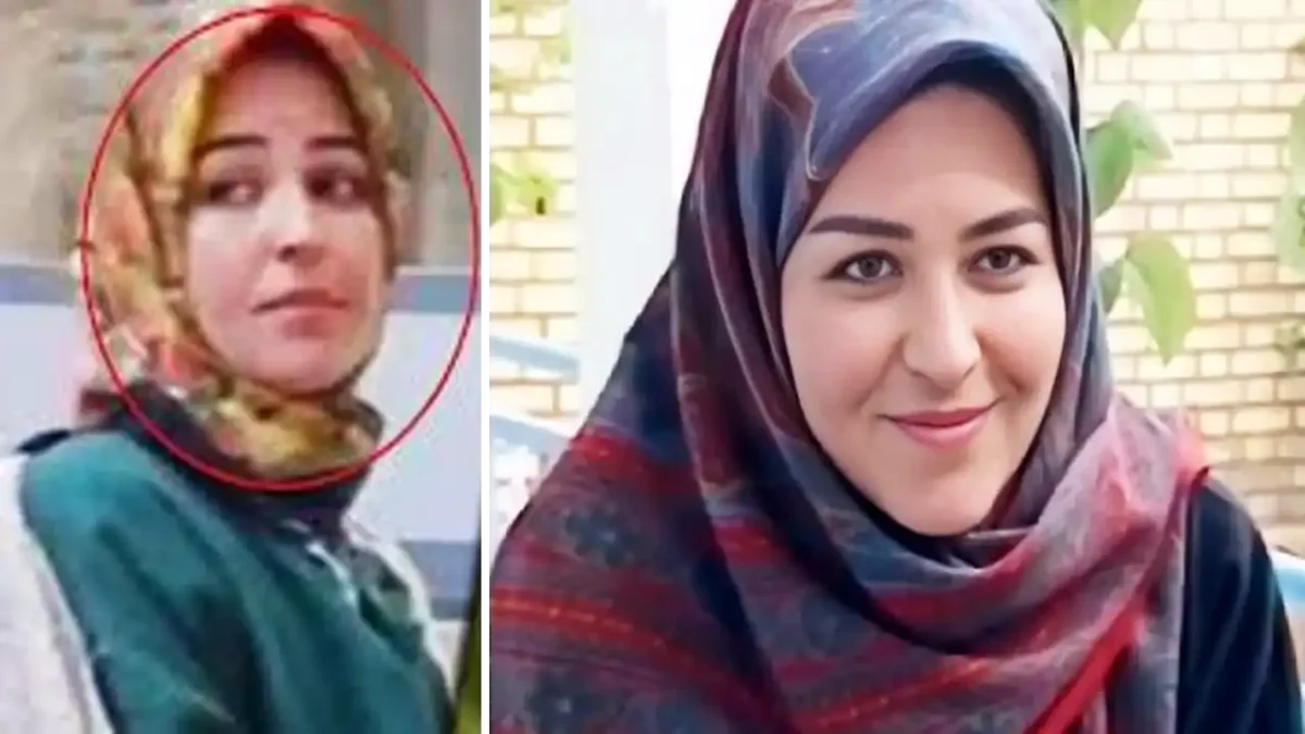 تغییر چهره اکرم محمدی