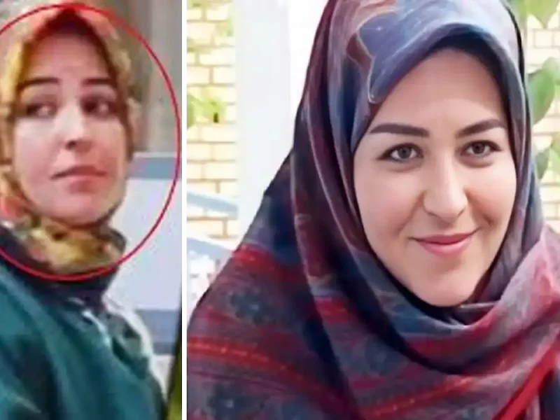 تغییر چهره اکرم محمدی