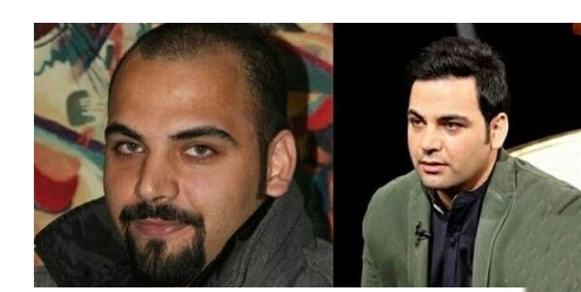 سکانس روز | عکس احسان علیخانی قبل کاشت مو وقتی کچل بود 2d595680