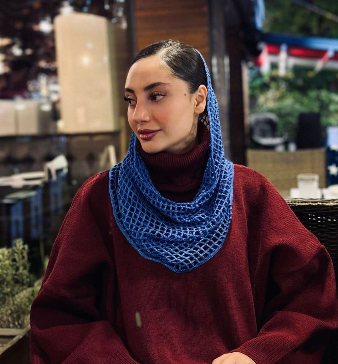 تاریخ وبگردی |تصویری شوکه کننده از تغییر چهره ترلان پروانه بازیگر سریال هوش سیاه