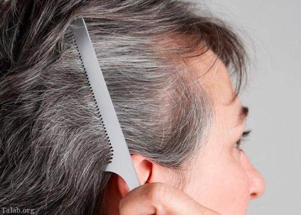 علت سفیدی مو