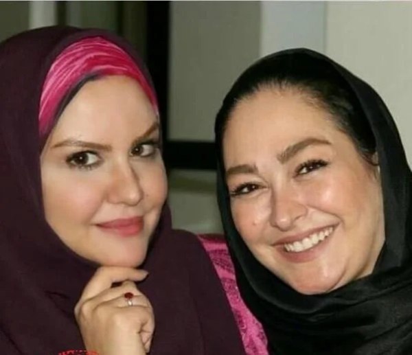 الهام حمیدی قبل از عمل زیبایی