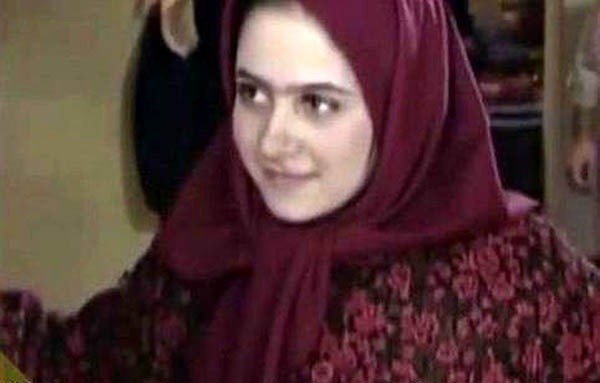 الناز حبیبی الناز حبیبی قبل و بعد عمل
