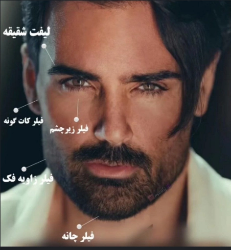 خبر روز | عکس آقای خواننده ایرانی با جراحی چهرهاش را کوبید و از نو ساخت fea162fb