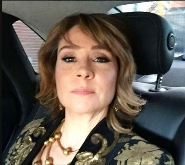 چهره مگان فالوز بازیگر نقش آن شرلی بعد از 36 سال