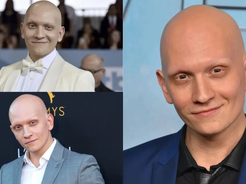 زندگی خصوصی آنتونی کاریگان، عکس‌های شخصی و بیوگرافی