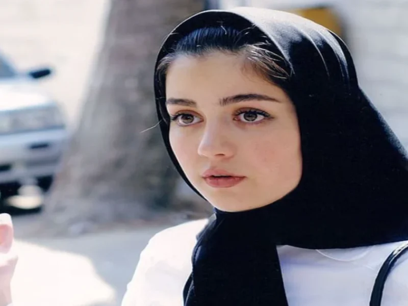 تغییر چهره باورنکرنی «افسانه پاکرو» بازیگر سریال رویای خیس در ترکیه