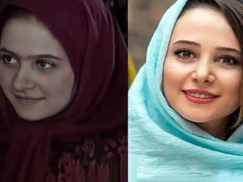 الناز حبیبی قبل و بعد از جراحی های زیبایی