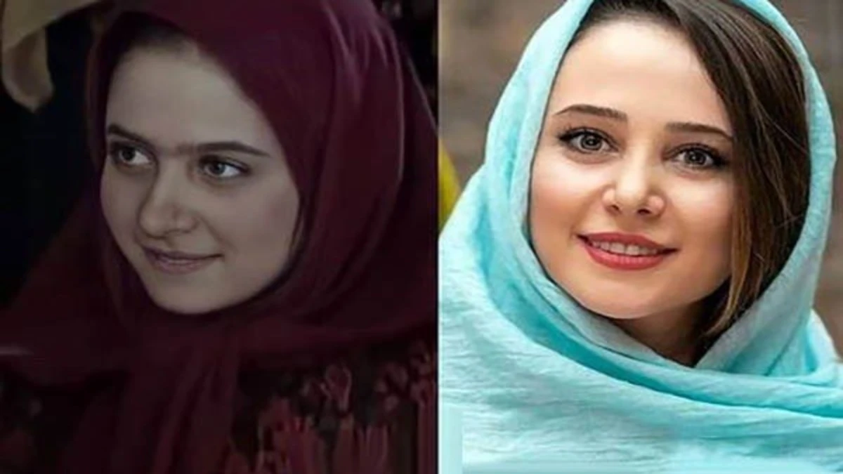الناز حبیبی قبل و بعد از جراحی های زیبایی