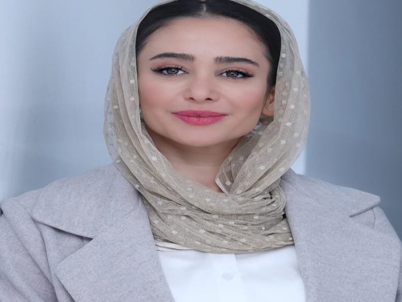 الناز حبیبی قبل و بعد از جراحی های زیبایی؛ چهره باورنکردنی