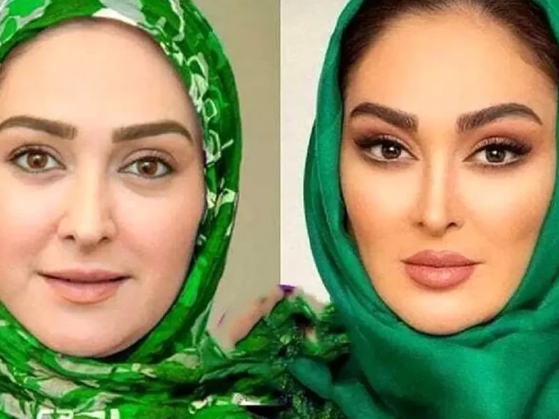 تصویر روز | چهره الهام حمیدی قبل معروف شدنش چهره الهام حمیدی قبل معروف شدنش