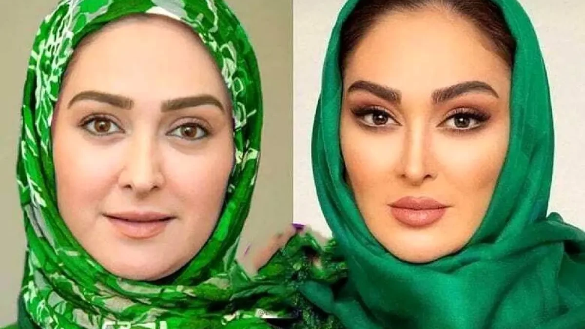 چهره الهام حمیدی قبل معروف شدنش