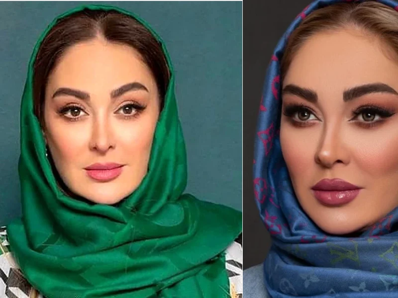 کودکی جذاب الهام حمیدی