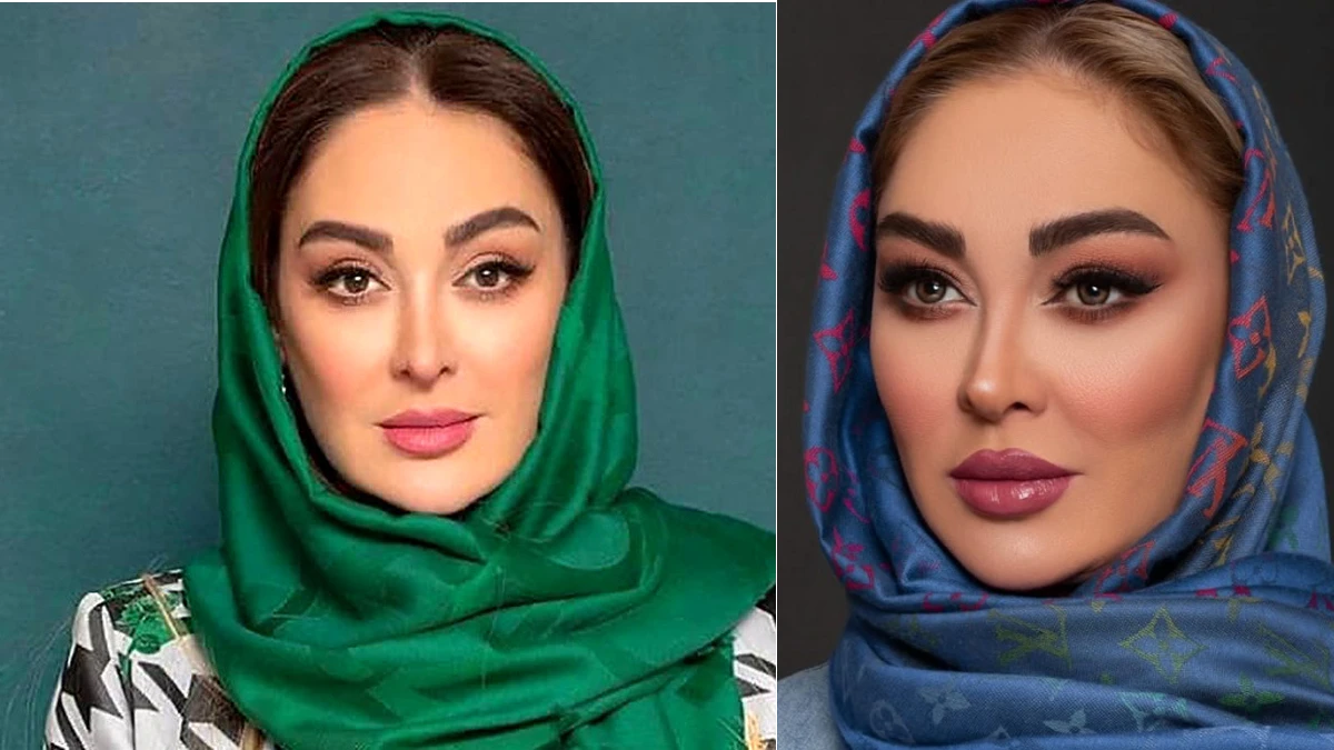 کودکی جذاب الهام حمیدی