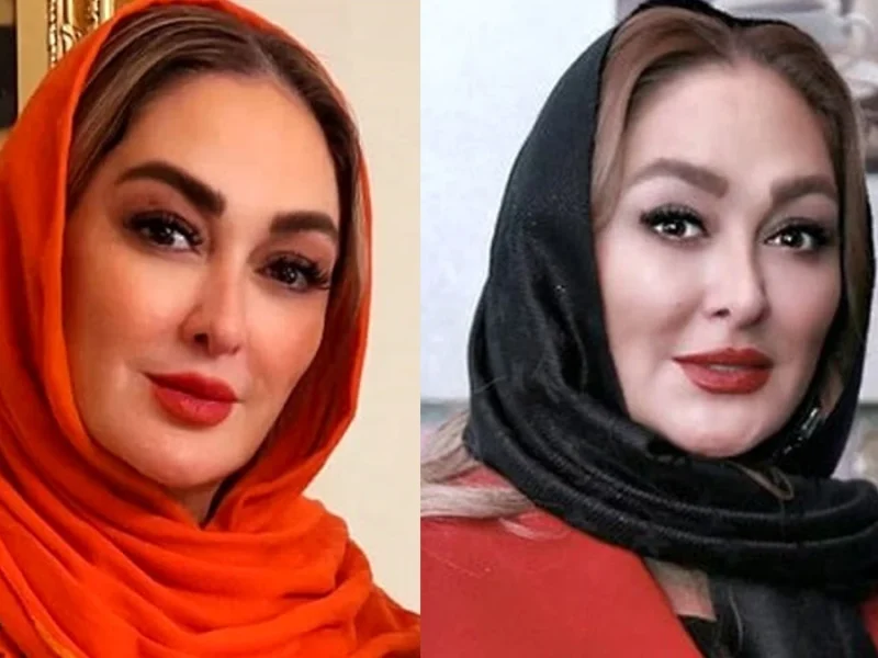 چهره الهام حمیدی قبل از عمل