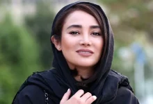 تغییر چهره عجیب و ناگهانی بهاره افشاری
