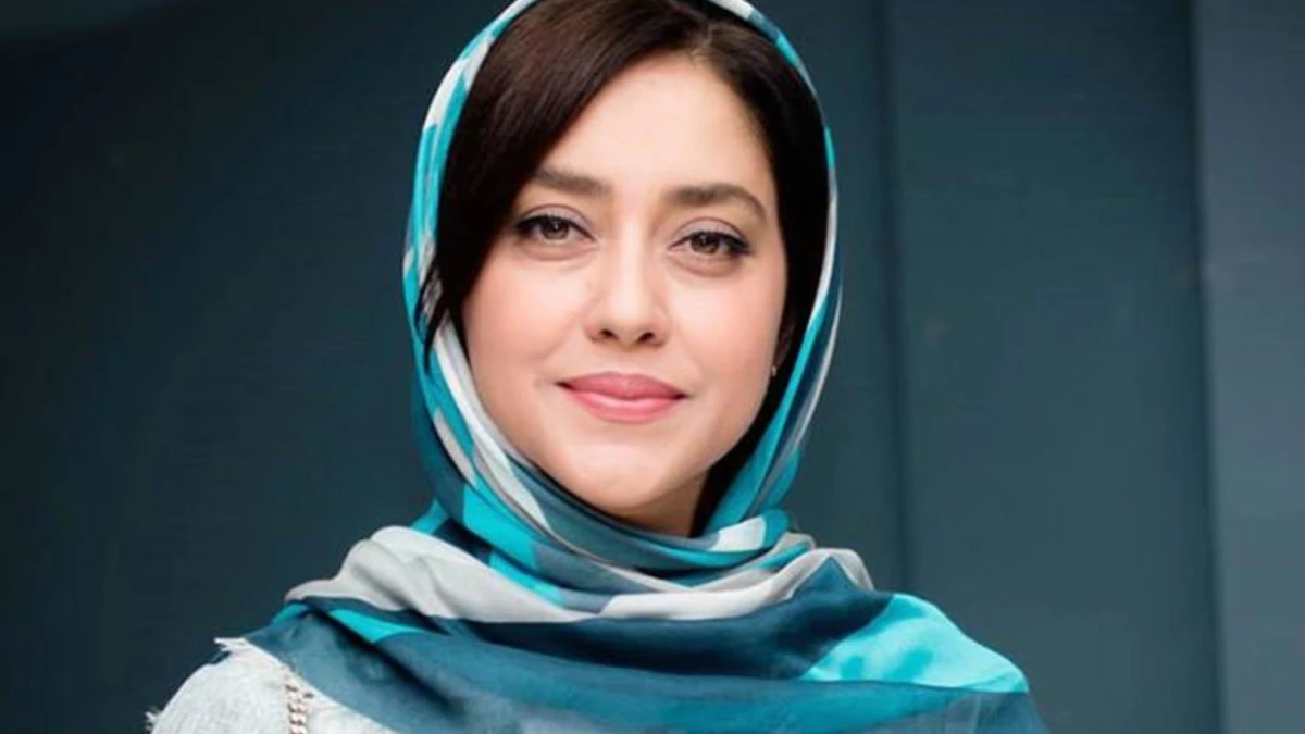 تغییر چهره زیبایی از بهاره کیان افشار در سن ۴۱سالگی