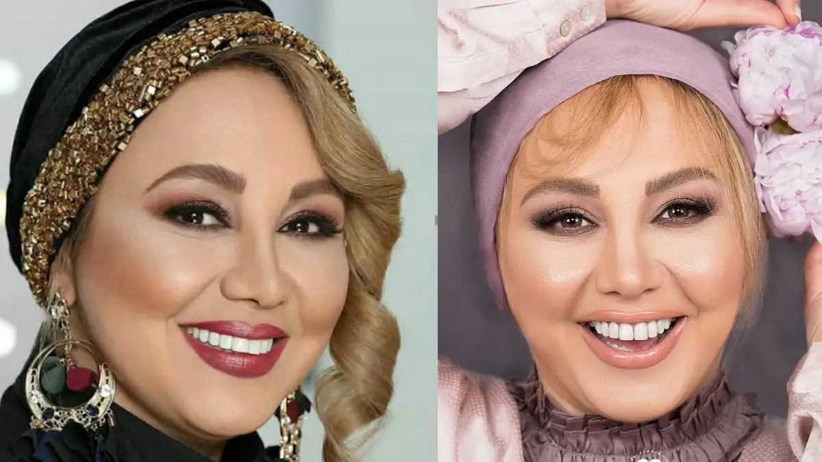 موهای عجیب و دیدنی بهنوش بختیاری؛ شبیه به آن شرلی