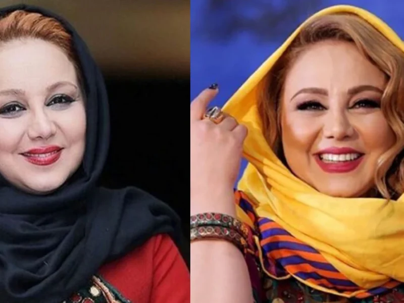 بهنوش بختیاری با فیلترهای اینستاگرامی یا عمل های زیبایی
