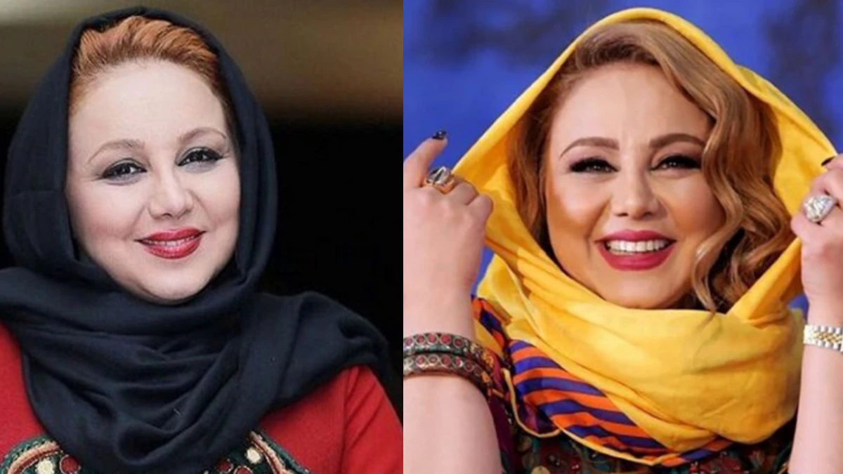 بهنوش بختیاری با فیلترهای اینستاگرامی یا عمل های زیبایی