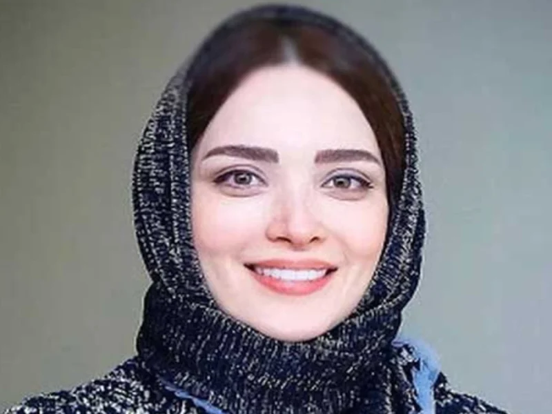 تغییرات جدید چهره بهنوش طباطبایی همیشه خوشتیپ در آسانسور