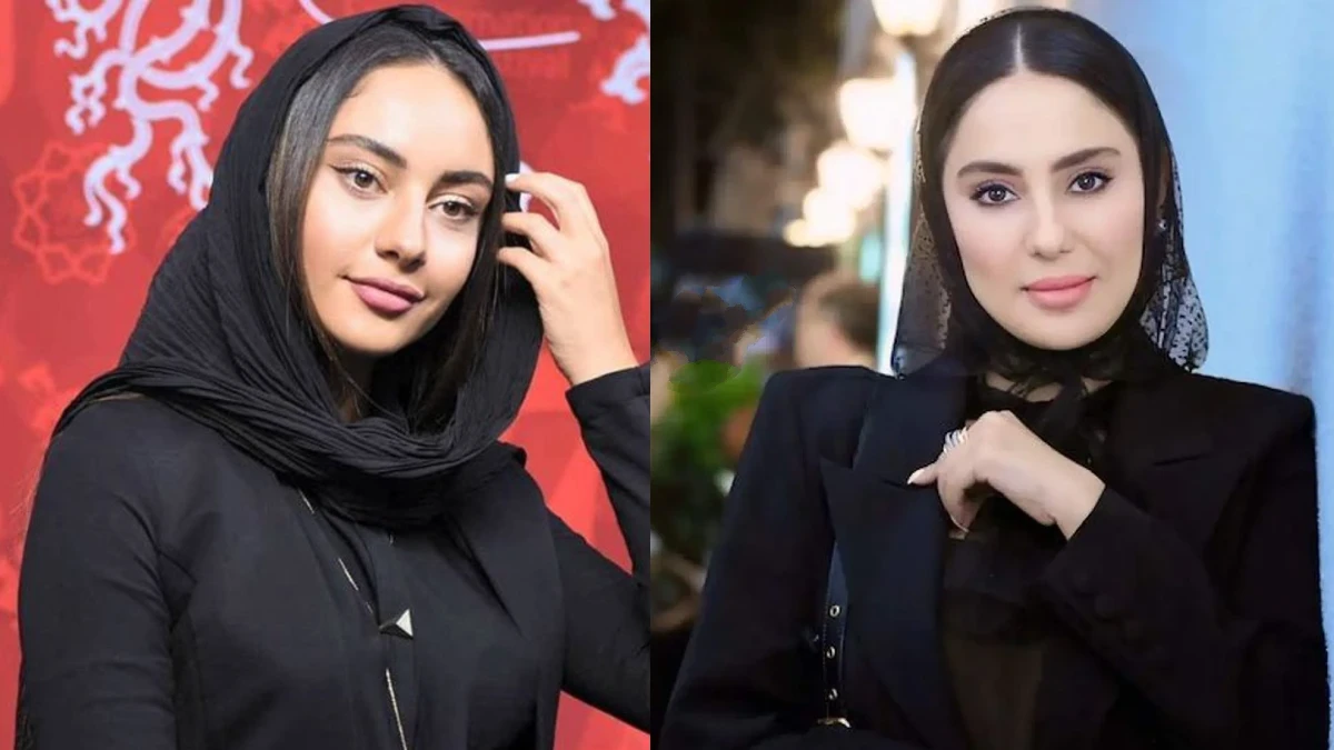 ترلان پروانه با چهره جدیدش در کنار شیدا یوسفی