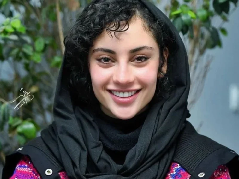 از ترلان پروانه با فیسی حیرت آور