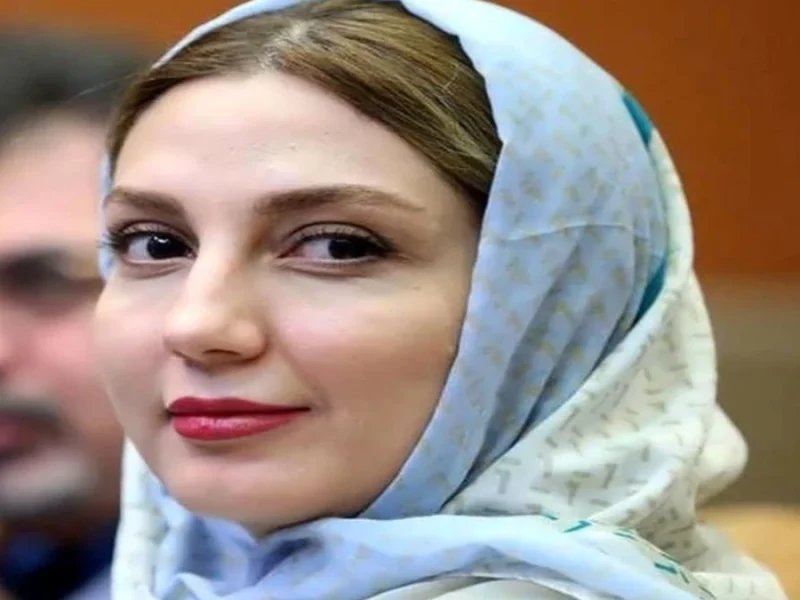 چهره حدیث میرامینی بعد از جوکر