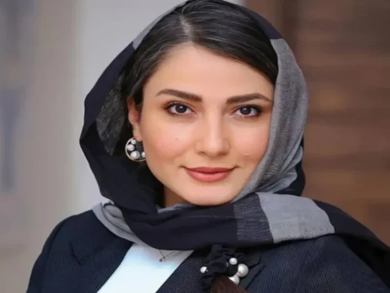 تغییر چهره «ناهید» سریال دلنوازان بعد 15 سال در سن 39 سالگی