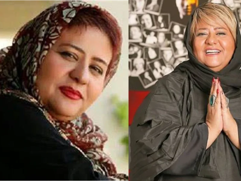 تغییر چهره زیبای رابعه اسکویی
