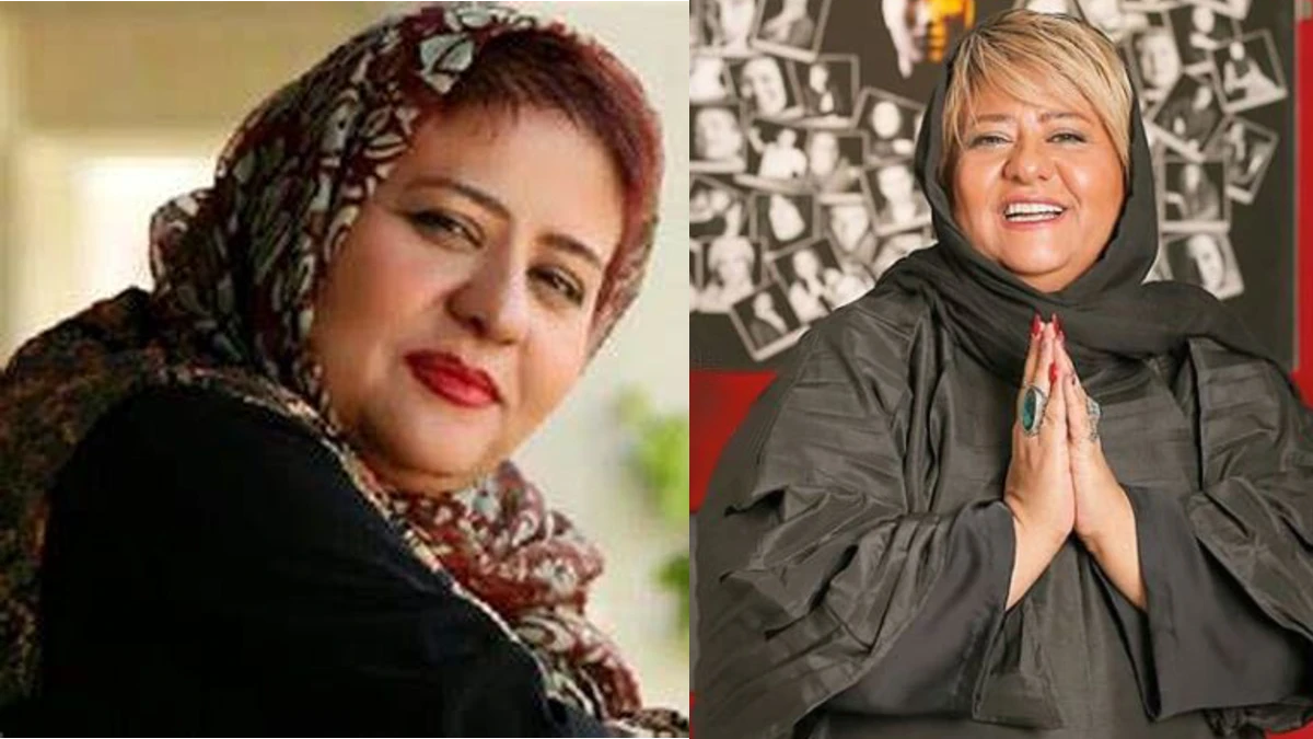 تصویر روز | تغییر چهره زیبای رابعه اسکویی تغییر چهره زیبای رابعه اسکویی