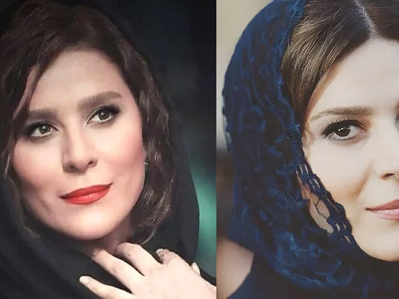 تصویر روز | تغییر چهره خانم بازیگر سحر دولتشاهی تغییر چهره خانم بازیگر سحر دولتشاهی