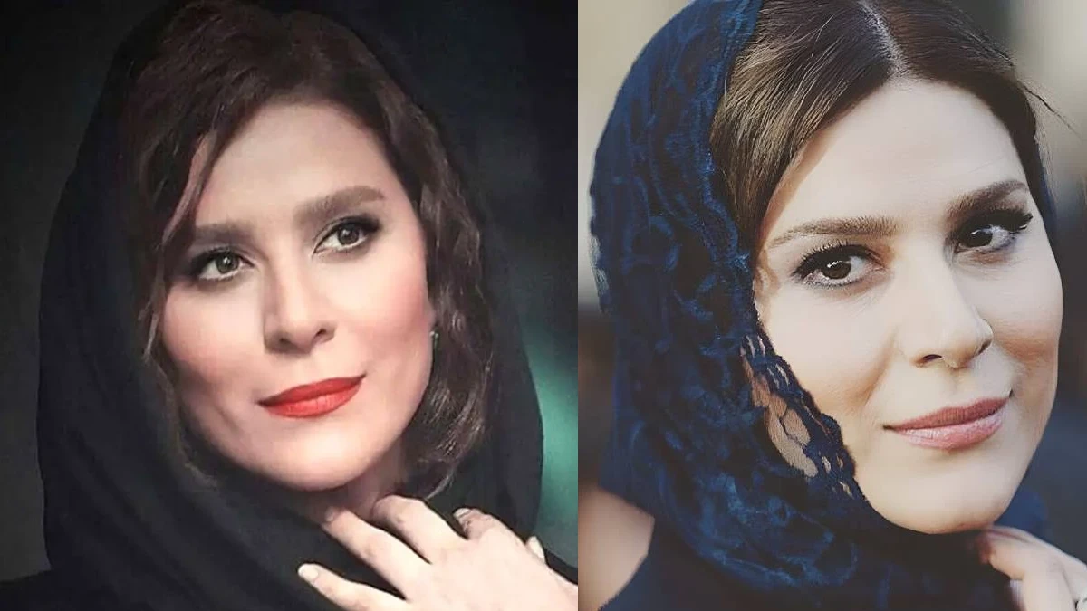 تغییر چهره خانم بازیگر سحر دولتشاهی