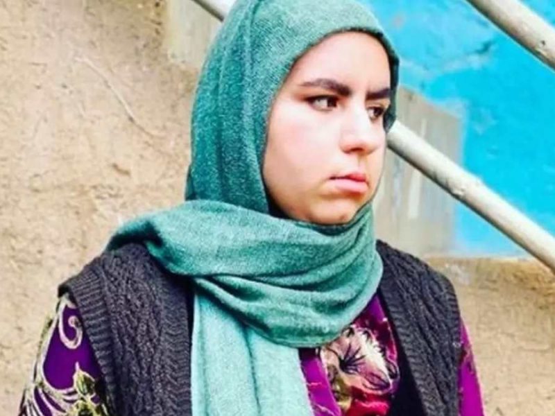 تغییر چهره دیدنی نقش روناک «رونی کلمن دایی» سریال نون خ