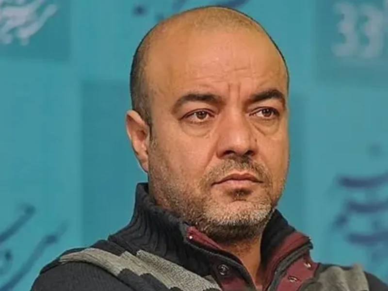 تغییرات بی نظیر چهره بازیگران از سعید آقاخانی تا نورا هاشمی
