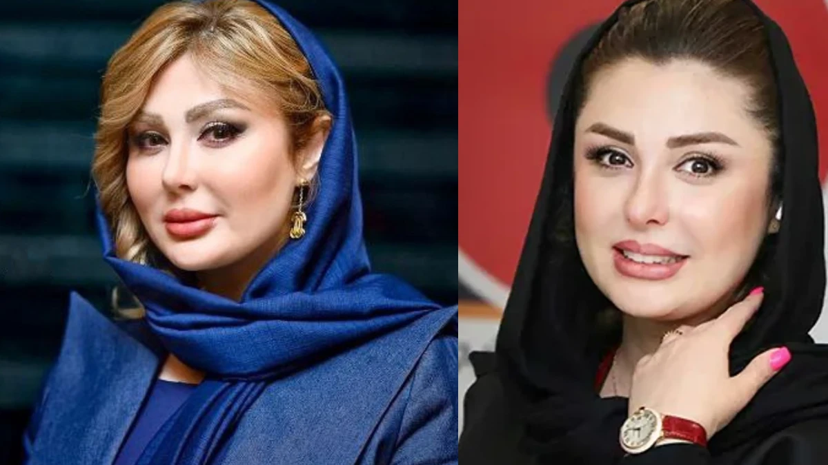 چهره تغییر یافته نیوشا ضیغمی که شبیه ستارههای هالیوود شده