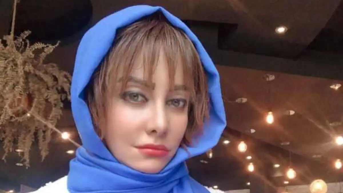 تغییر چهره دیدنی شراره رخام بعد از چاقی