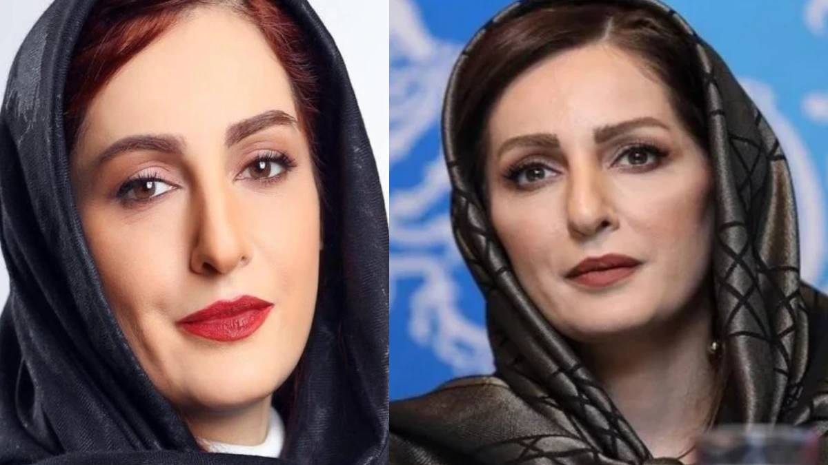 تغییر چهره نازنین بیاتی و شقایق دهقان