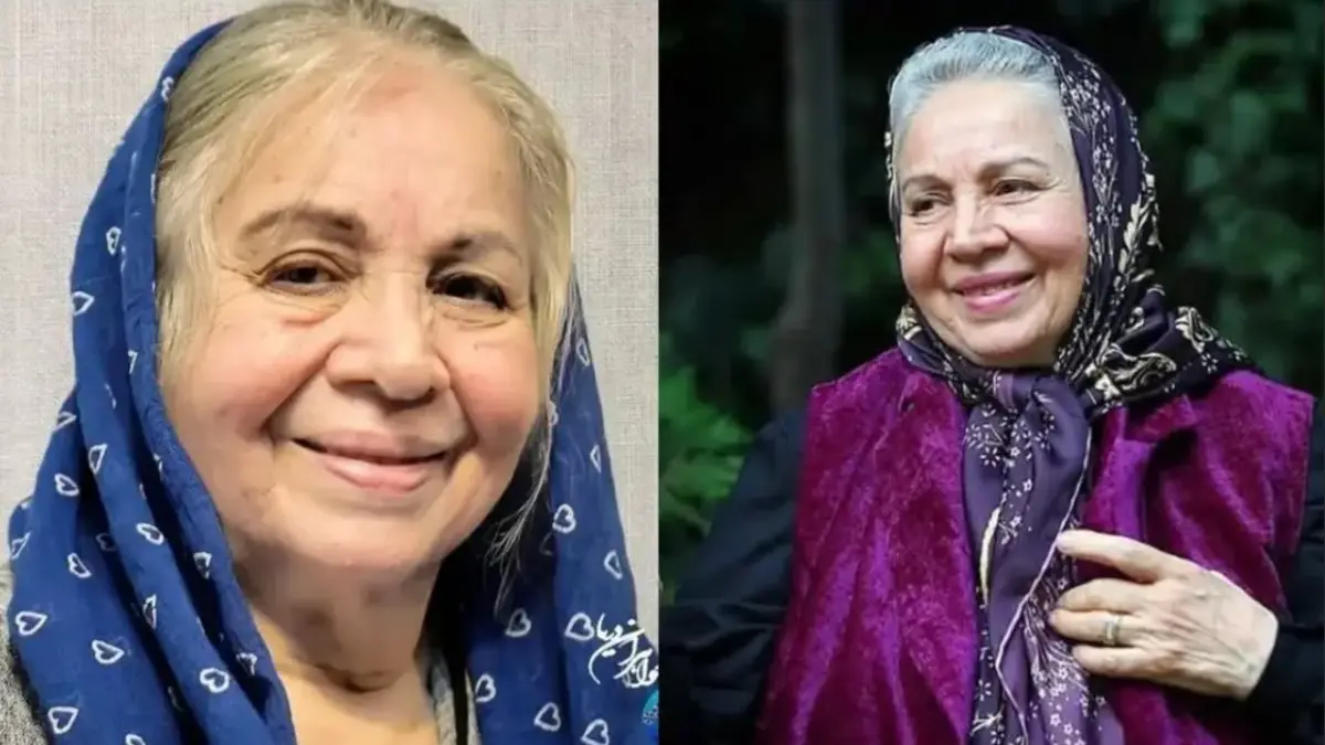 تغییر چهره شمسی فضل‌اللهی بازیگر سریال سه در چهار بعد از گذشت ۱۷ سال