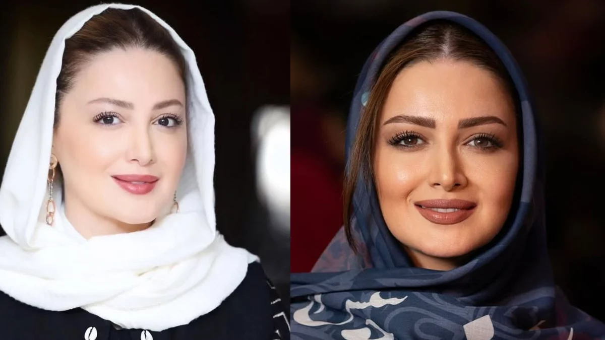 باور میکنید شیلا خداداد قبل از عمل بینی این شکلی بوده