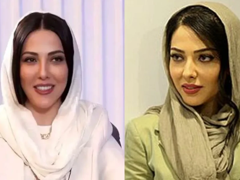 تصویر روز | تغییر چهره لیلا اوتادی؛ خانم بازیگر با سر کچل هم خوشتیپ و زیباست تغییر چهره لیلا اوتادی؛ خانم بازیگر با سر کچل هم خوشتیپ و زیباست
