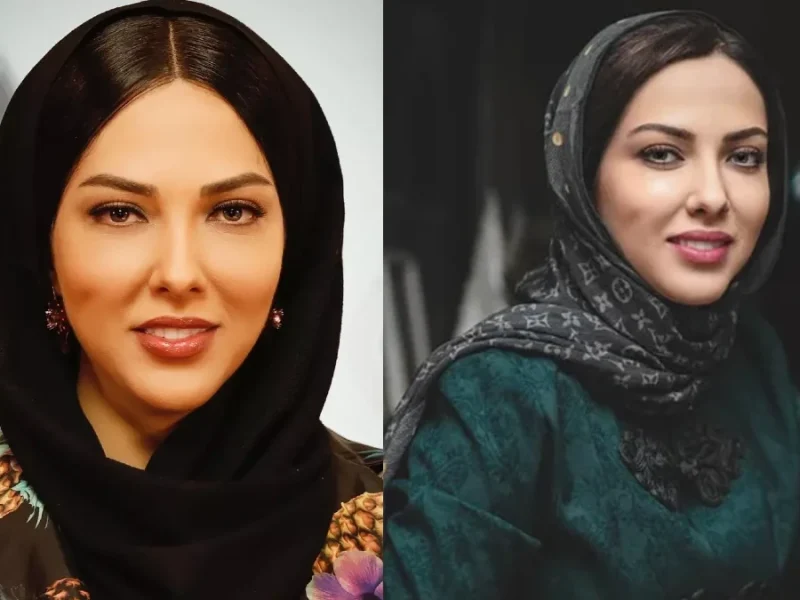 تصویر روز | تغییر چهره دیدنی لیلا اوتادی تغییر چهره دیدنی لیلا اوتادی