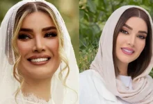 متین ستوده در خانه پدری و قبل از عمل های زیبایی