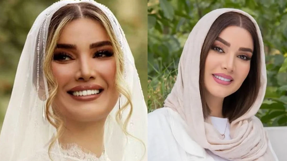 متین ستوده در خانه پدری و قبل از عمل های زیبایی