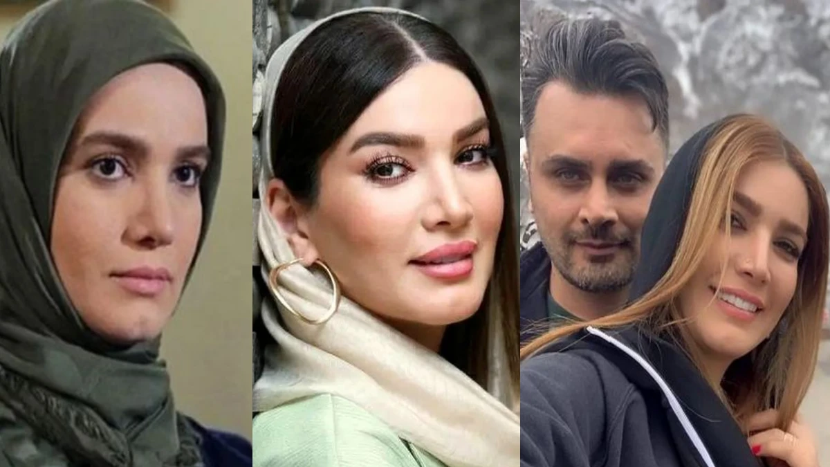 تغییرات چهره و استایل متین ستوده؛ عمل های زیبایی و لباس عروس شیکش
