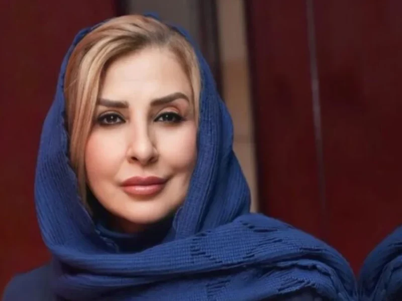 نگاهی خاص به تغییر چهره مرجانه گلچین و نرگس آبیار