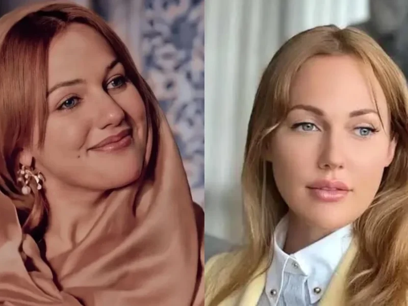 تصویر روز | چهره تازه مریم اوزرلی بدون آرایش و بعد از تزریق ژل و بوتاکس چهره تازه مریم اوزرلی بدون آرایش و بعد از تزریق ژل و بوتاکس